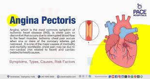 angina information words